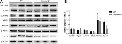 TMPRSS12 Functions in Meiosis and Spermiogenesis and Is Required for Male Fertility in Mice